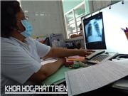“Săn” bệnh nhân lao bằng công nghệ xét nghiệm