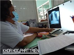 “Săn” bệnh nhân lao bằng công nghệ xét nghiệm