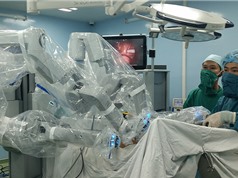 Robot phẫu thuật hơn gì phẫu thuật viên?