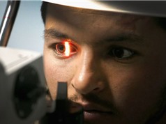 Thuật toán AI mới của Google dự đoán bệnh tim mạch bằng ảnh chụp đôi mắt