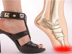 Giày cao gót ảnh hưởng xấu tới xương khớp và dáng đi