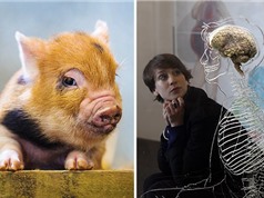 Não lợn sống hai ngày ngoài cơ thể, tiếp đến là não người?