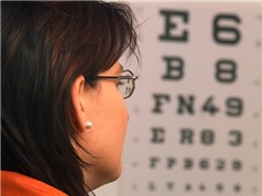 Dùng tia laser siêu nhanh điều trị bệnh cận thị