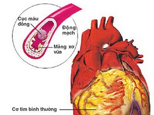 Mỗi năm 40.000 người Việt Nam tử vong do các bệnh liên quan đến thuốc lá 