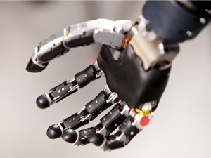 Người đầu tiên sống với cánh tay robot điều khiển bằng tâm trí Người đầu tiên sống với cánh tay robot điều khiển bằng tâm trí