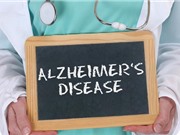 Béo phì có thể liên quan tới khởi phát sớm bệnh Alzheimer