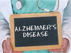 Béo phì có thể liên quan tới khởi phát sớm bệnh Alzheimer