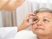 Mối liên hệ đặc biệt giữa bệnh Alzheimer và các bệnh về mắt