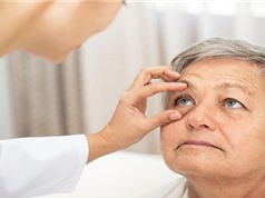 Mối liên hệ đặc biệt giữa bệnh Alzheimer và các bệnh về mắt