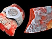 [Video] Công nghệ chụp X-quang màu 3D cơ thể người