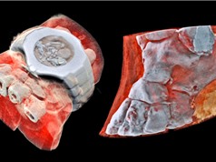 [Video] Công nghệ chụp X-quang màu 3D cơ thể người