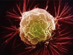 Mỹ phát triển mạng nơron giúp chẩn đoán chính xác nguy cơ ung thư vú
