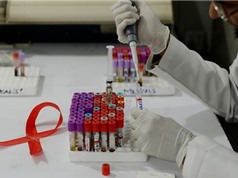 Israel xây nhà máy công nghệ sinh học đầu tiên sản xuất thuốc trị AIDS