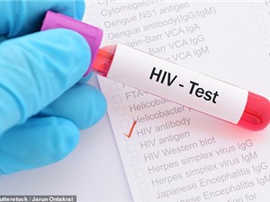 Phát hiện cơ chế giúp chữa khỏi HIV ngay trong não người