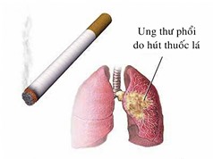 Tiến trình phục hồi của phổi sau khi ngừng hút thuốc
