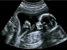 Nghiên cứu: Các em bé hình thành bản đồ tư duy ngay từ khi còn trong bụng mẹ