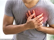 Phương pháp giá rẻ dự đoán nhồi máu cơ tim từ… 10 năm trước