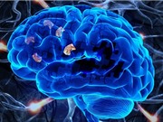 Phát hiện hiệu quả trị bệnh Alzheimer của loại thuốc ngừa đột quỵ