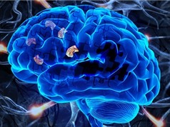 Phát hiện hiệu quả trị bệnh Alzheimer của loại thuốc ngừa đột quỵ