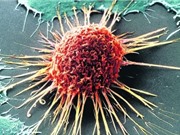 Phát hiện phương pháp mới ngăn chặn tế bào ung thư phát triển
