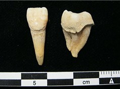 Cao răng cổ đại cho thấy người Mông Cổ đã biết sử dụng sữa từ 3.000 năm trước