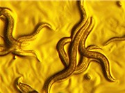 Phát hiện ra loại vi khuẩn “vàng” có khả năng “tiêu diệt” giun ký sinh