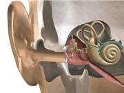 Ca phẫu thuật thay xương tai giữa đầu tiên trên thế giới