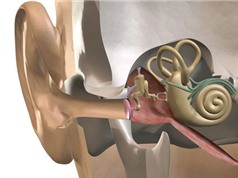 Ca phẫu thuật thay xương tai giữa đầu tiên trên thế giới