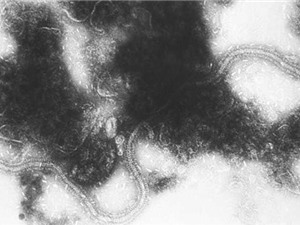 Nhà khoa học Chile tìm ra vắcxin chống virus gây viêm phổi cấp