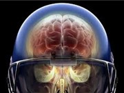 Chấn thương đầu khiến protein tau tích lũy trong não