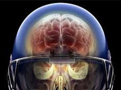 Chấn thương đầu khiến protein tau tích lũy trong não