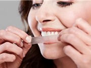 Miếng dán làm trắng có thể gây hại cho răng