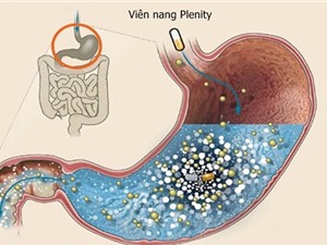 Viên nang giúp giảm cân và điều trị béo phì