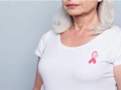 Trí tuệ nhân tạo giúp chẩn đoán ung thư vú nhanh, chính xác hơn