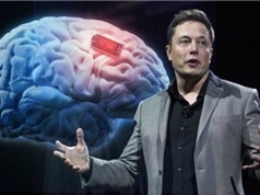 Elon Musk giới thiệu con chip có thể cấy vào não người