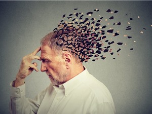 Xét nghiệm máu chẩn đoán chính xác Alzheimer trước 20 năm