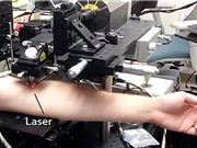 Công nghệ laser giúp phát hiện sớm và tiêu diệt tế bào ung thư