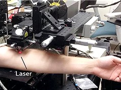 Công nghệ laser giúp phát hiện sớm và tiêu diệt tế bào ung thư