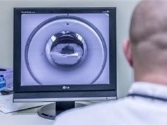 Nga phát triển máy chụp cộng hưởng từ MRI với nhiều ưu điểm vượt trội