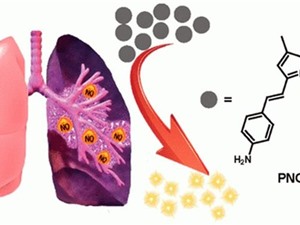 Các nhà khoa học tìm ra cách phát hiện sớm bệnh xơ phổi