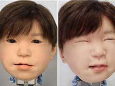 Nhật Bản tạo ra robot có thể cảm nhận nỗi đau