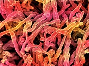 Phân lập xạ khuẩn có khả năng kháng vi khuẩn và nấm bệnh từ đất