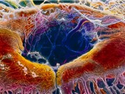 Chỉnh sửa gene trực tiếp trên cơ thể người để chữa bệnh mù lòa bẩm sinh