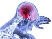 Úc tìm được cách phục hồi não sau chấn thương