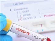 Hai phương pháp xét nghiệm chẩn đoán COVID-19 đang được sử dụng ở Việt Nam