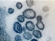 Biến dị hệ gene giúp hiểu rõ hơn quá trình coronavirus lây lan
