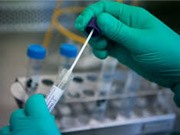 RT-PCR thời gian thực: “Chuẩn vàng” để xét nghiệm SARS-CoV-2 