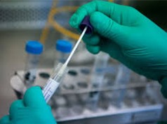 RT-PCR thời gian thực: “Chuẩn vàng” để xét nghiệm SARS-CoV-2 