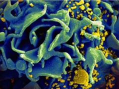 Phát triển phân tử nano ngăn ngừa lây nhiễm virus HIV  