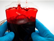 Theo dõi số liệu máu toàn cầu có thể ngăn chặn đại dịch tiếp theo?